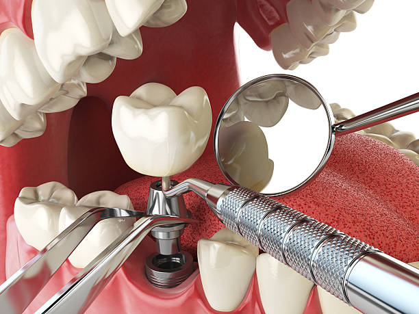 Best Walk-In Emergency Dentist in Wadsworth, IL